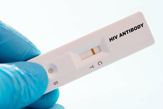 公共场所接触用过的HIV试剂盒！疾控专家：体外病毒活性弱，感染风险很小